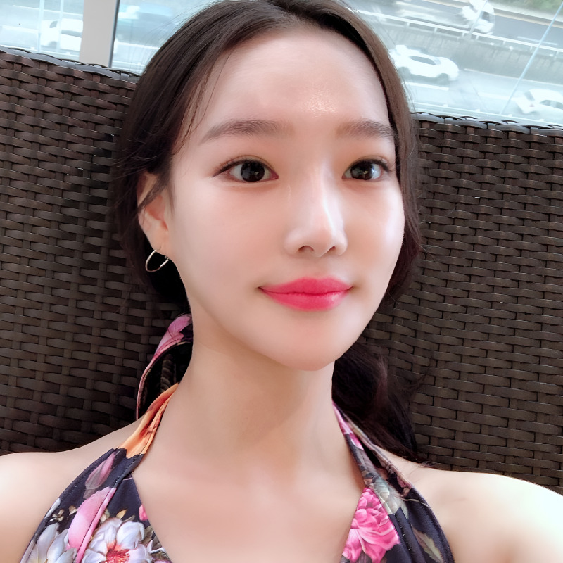 압구정입꼬리필러 하나로 인상이 완전히 달라졌어요ㅠㅠ 관련 이미지 4