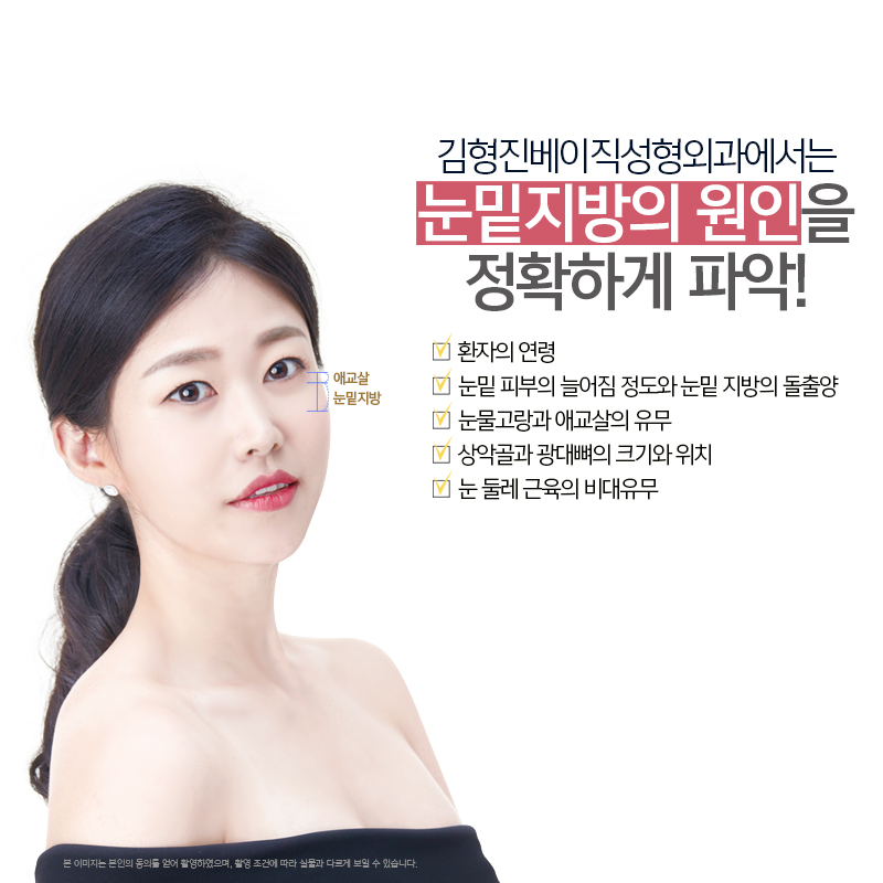 피곤해보일땐 눈밑지방재배치수술이 딱! 관련 이미지 7
