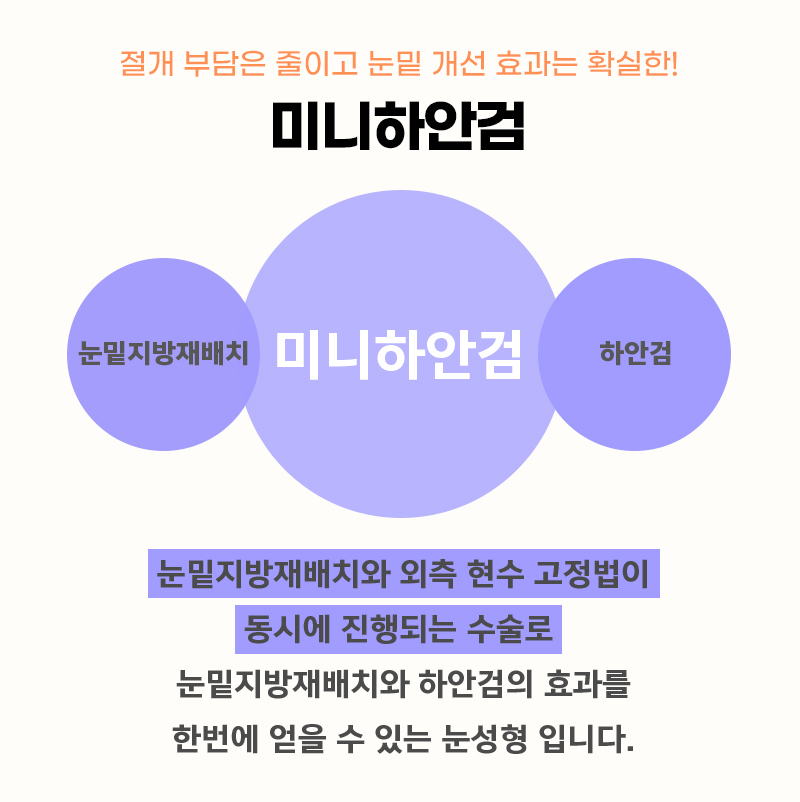 중년하안검으로 나이 들어 보이는 원인 해결했어요 관련 이미지 3