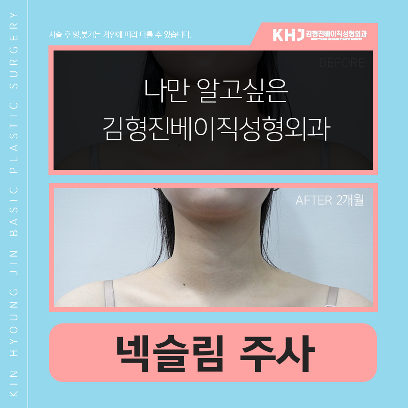 넥슬림주사후기 궁금하시죠? 관련 이미지 6