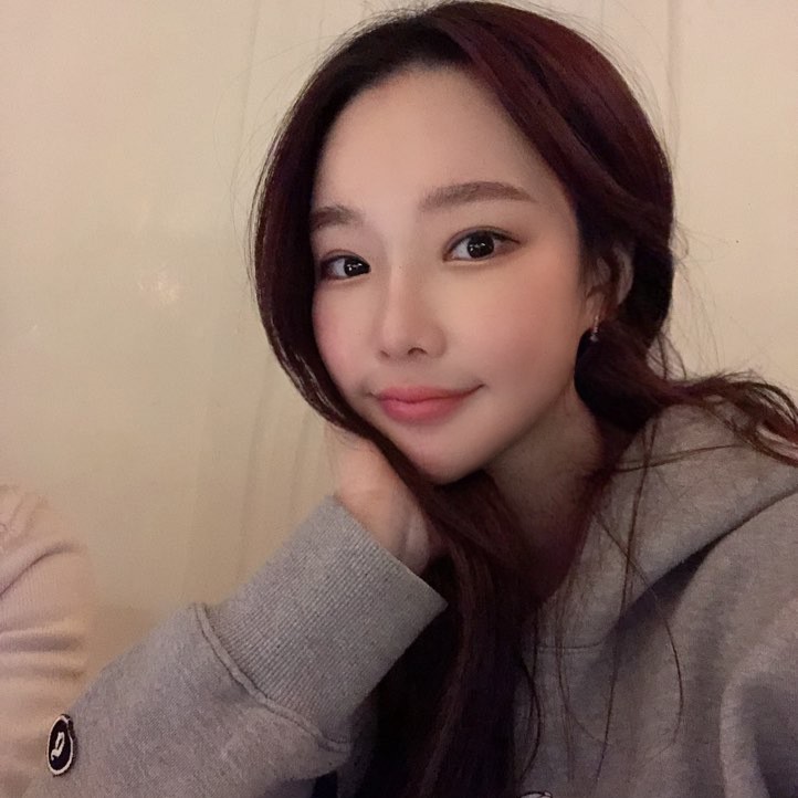 절대 안빠지는 턱살, 이중턱살빼는수술로 극복한 후기 관련 이미지 1