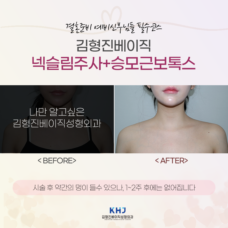 넥슬림주사효과? 이런 것도 있어요! 관련 이미지 6