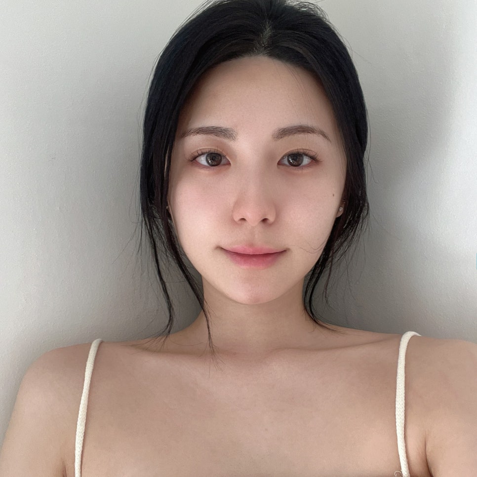 솔직한 넥슬림주사후기 목부터 어깨 라인까지 확 달라졌어요! 관련 이미지 1