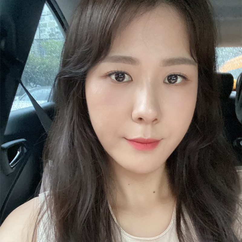 압구정눈밑지방재배치 여기예요~! 관련 이미지 3