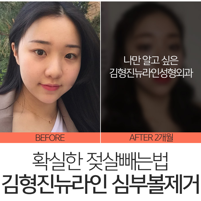 젖살빼는법 따로 있어요 관련 이미지 8