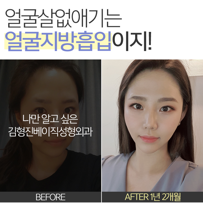 얼굴살없애기 이걸 몰랐단 말이야? 관련 이미지 3