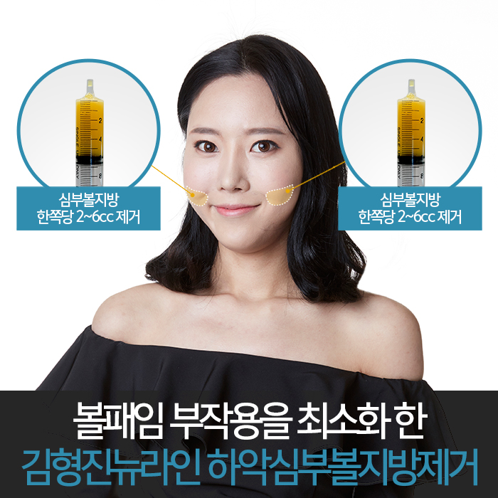 심부볼위치 정확하게 요기 관련 이미지 5