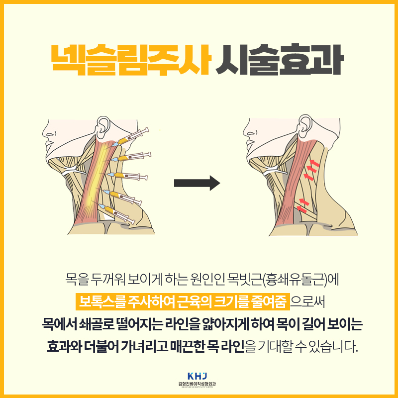 넥슬림주사효과 이런 목라인이 가능하네요..? 관련 이미지 4