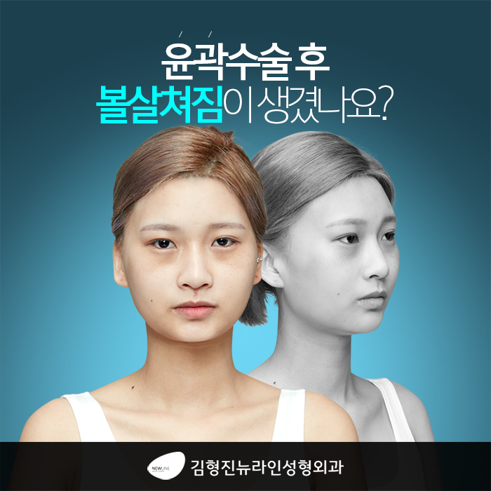 볼살쳐짐 어이 하늬? 관련 이미지 1