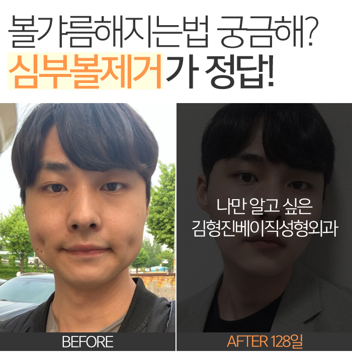 볼갸름해지는법 다 알고 있는데 관련 이미지 8