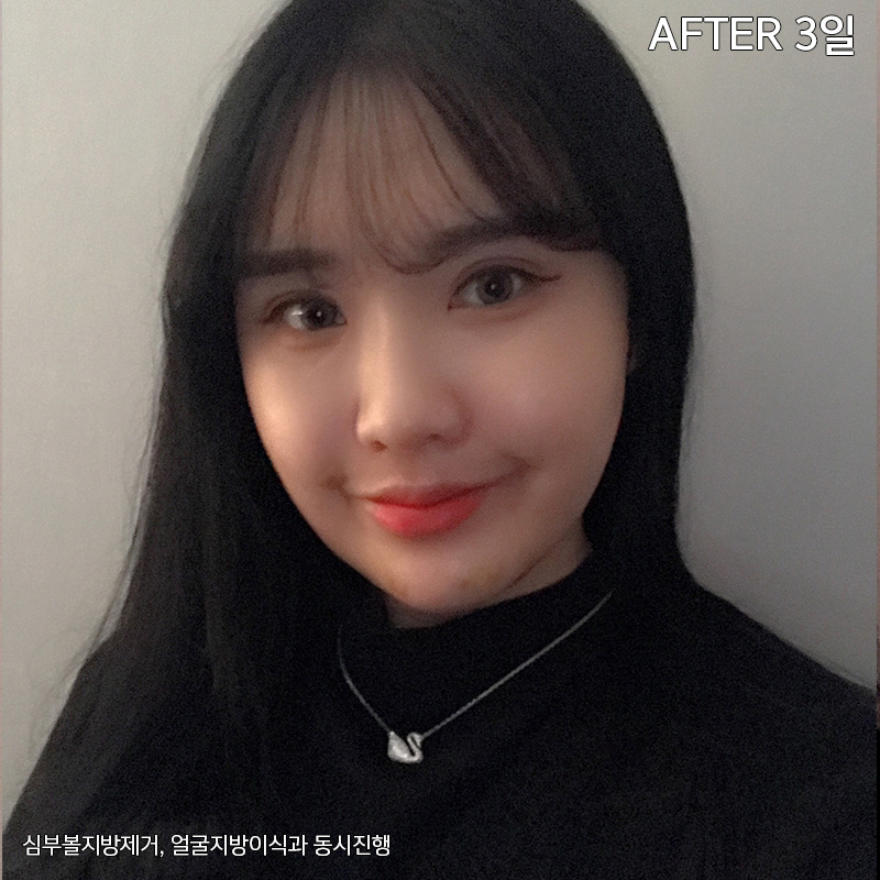 이중턱해결법 아직 모르신다구요? 관련 이미지 3