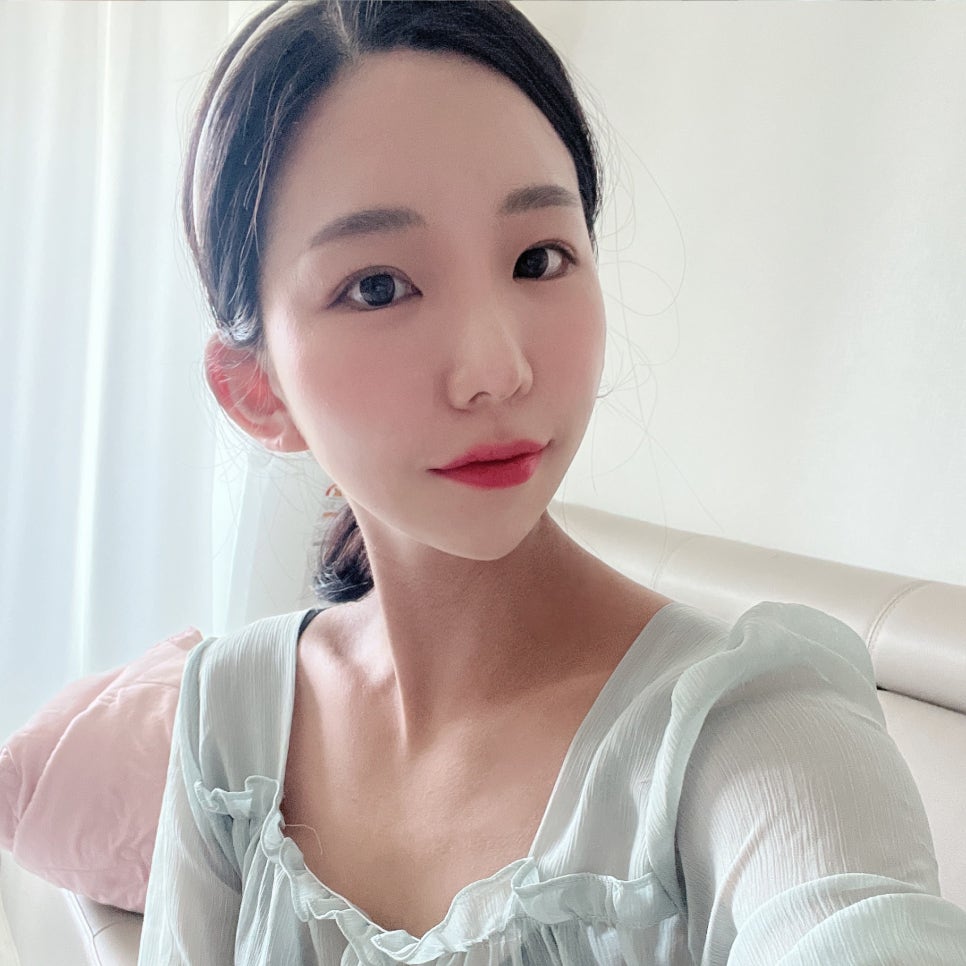 침샘보톡스시술로 숨어있던 턱라인 찾았어요ㅠㅠ 관련 이미지 3