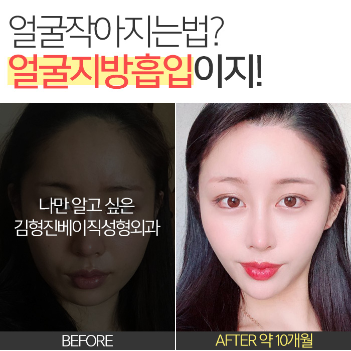 얼굴작아지는법 이것저것 하지말고 하나만 딱! 관련 이미지 2
