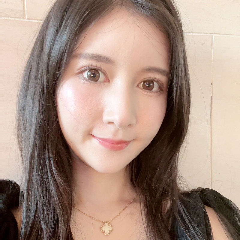 눈밑지방재배치재발 걱정 없는 이유 관련 이미지 1