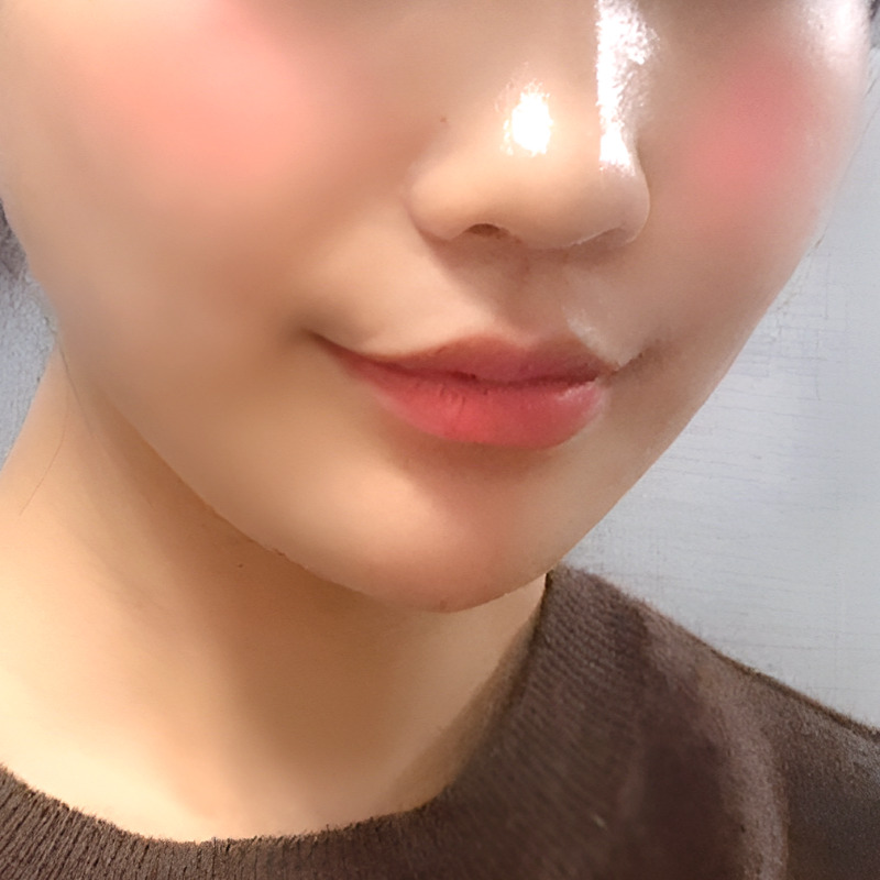 너무 쉽게 입꼬리올리는법 김형진베이직에서 알려드려요! 관련 이미지 3