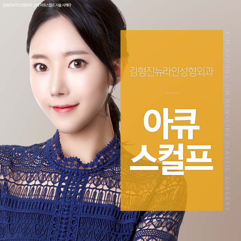 아큐스컬프후기 아주 좋아 관련 이미지 1
