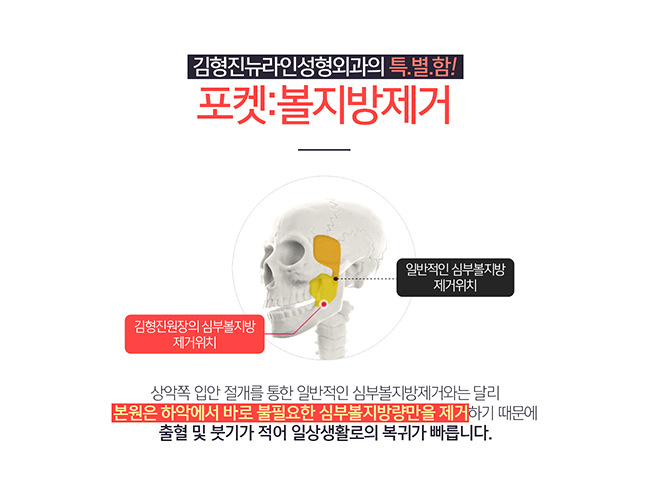 부산심부볼 여기서 빼자~! 관련 이미지 4