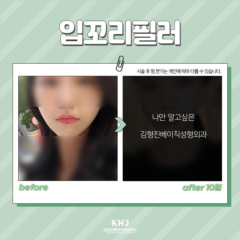 처진입꼬리 개선방법 이렇게나 간단해! 관련 이미지 3