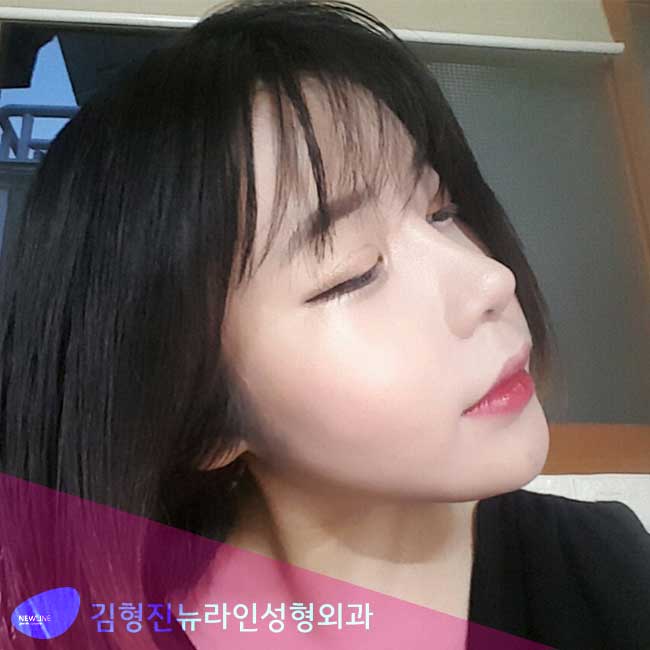 얼굴V라인 때문에 셀카중독! 관련 이미지 2