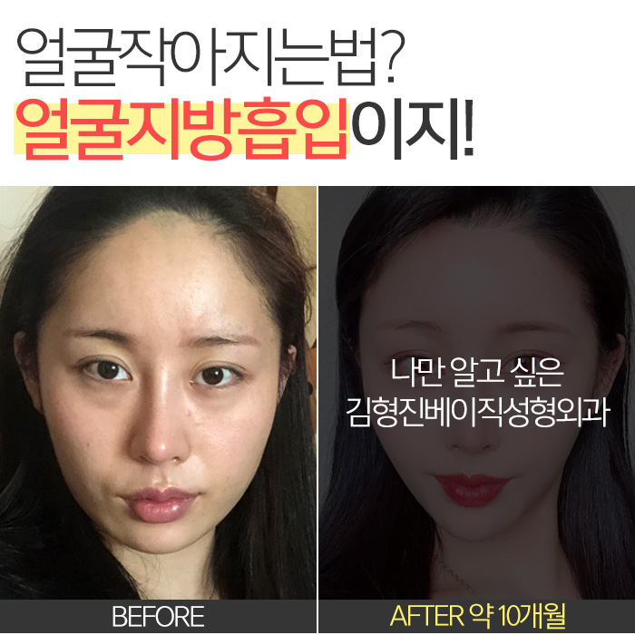 얼굴작아지는법 이것저것 하지말고 하나만 딱! 관련 이미지 3