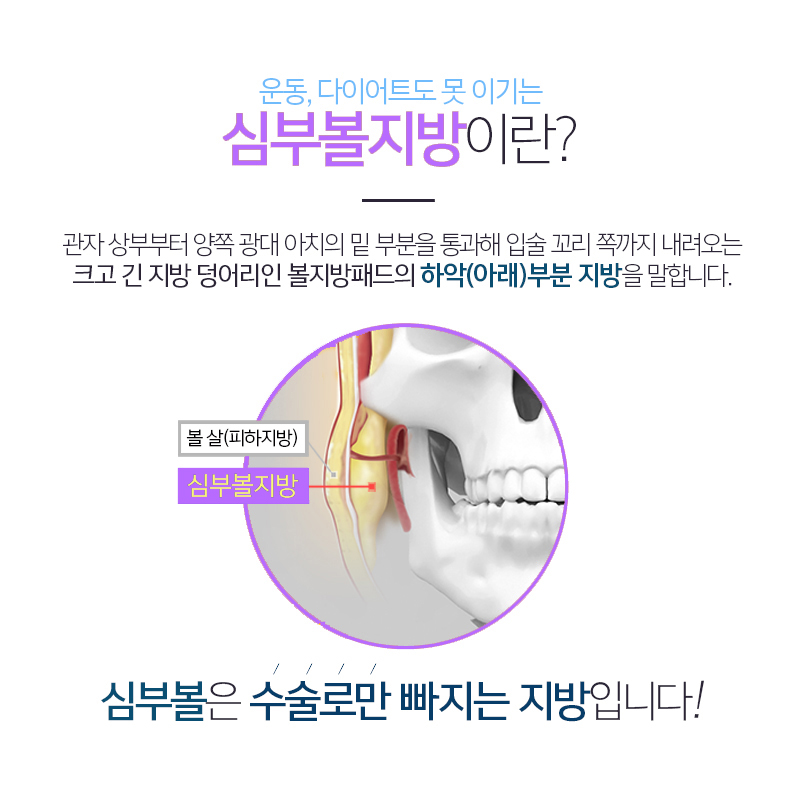 당신만 몰랐던 진짜 볼살없애는법 관련 이미지 4