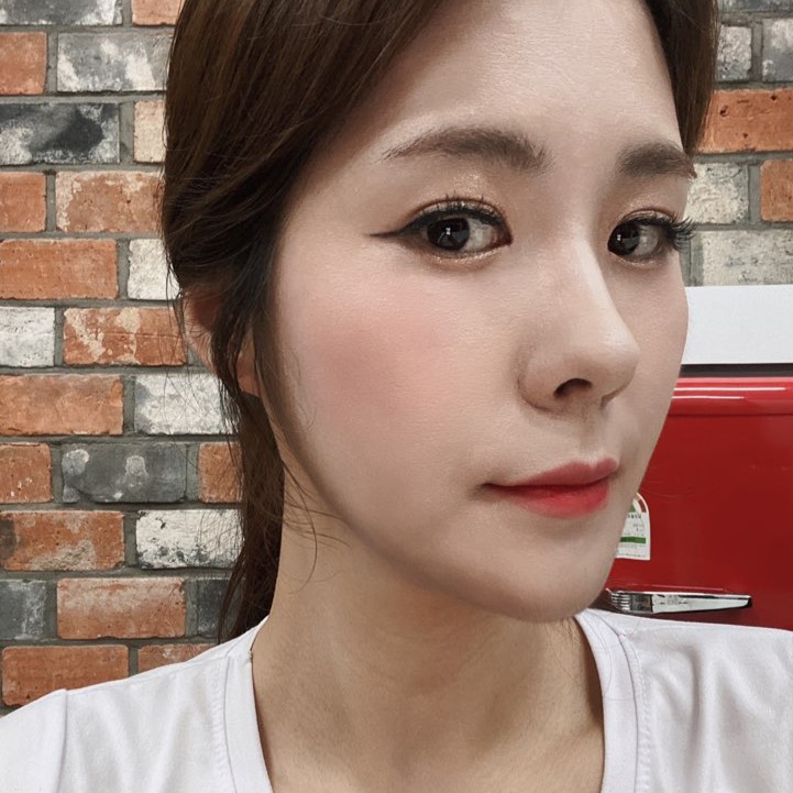 눈밑지방재배치병원 애교살 그대로 유지되는 곳 관련 이미지 3