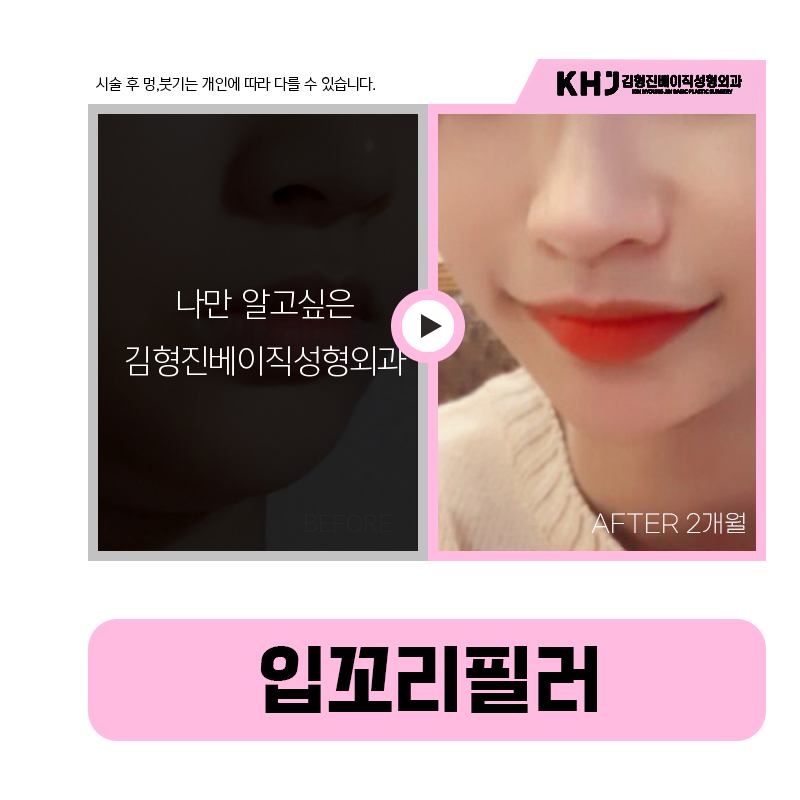 하루 만에 입꼬리올리는법 보고 가실래요? 관련 이미지 6