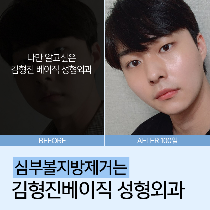 심부볼패임 너무 걱정된다구요? 관련 이미지 3