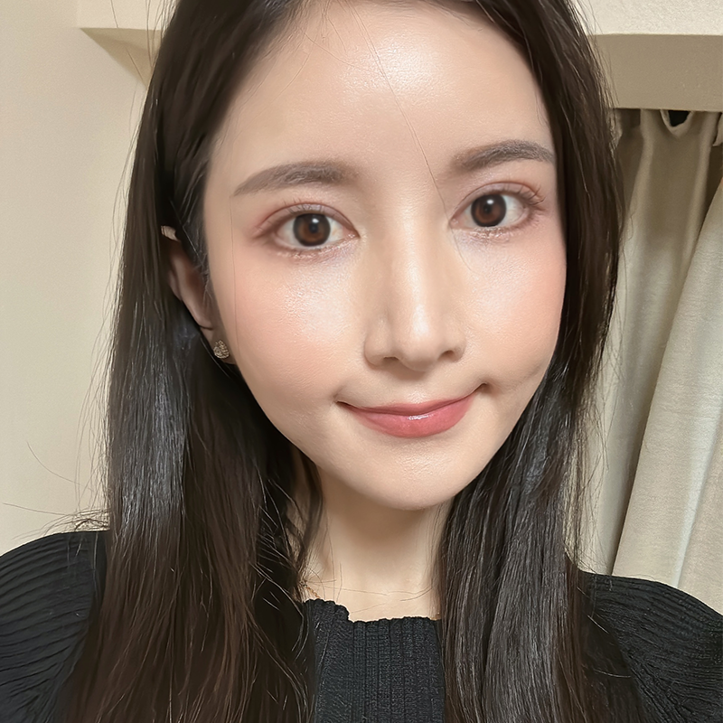 눈밑지방재배치잘하는병원 김형진베이직이죠! 관련 이미지 7