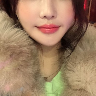 입꼬리필러시술 잘하는 곳 아직도 모르시나요? 관련 이미지 3