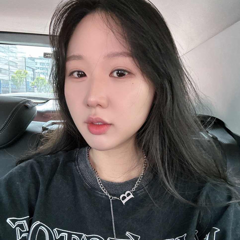 얼굴지방흡입 받고 이미지 변신 제대로 했어요 관련 이미지 3