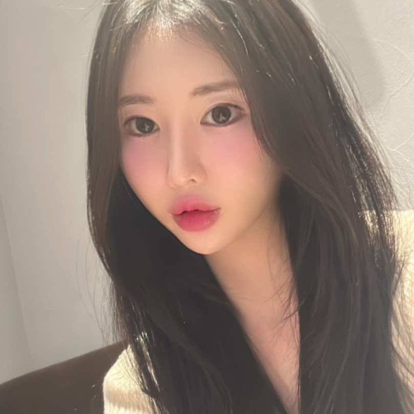 눈밑지방수술 했더니 인상까지 좋아졌어요! 관련 이미지 2