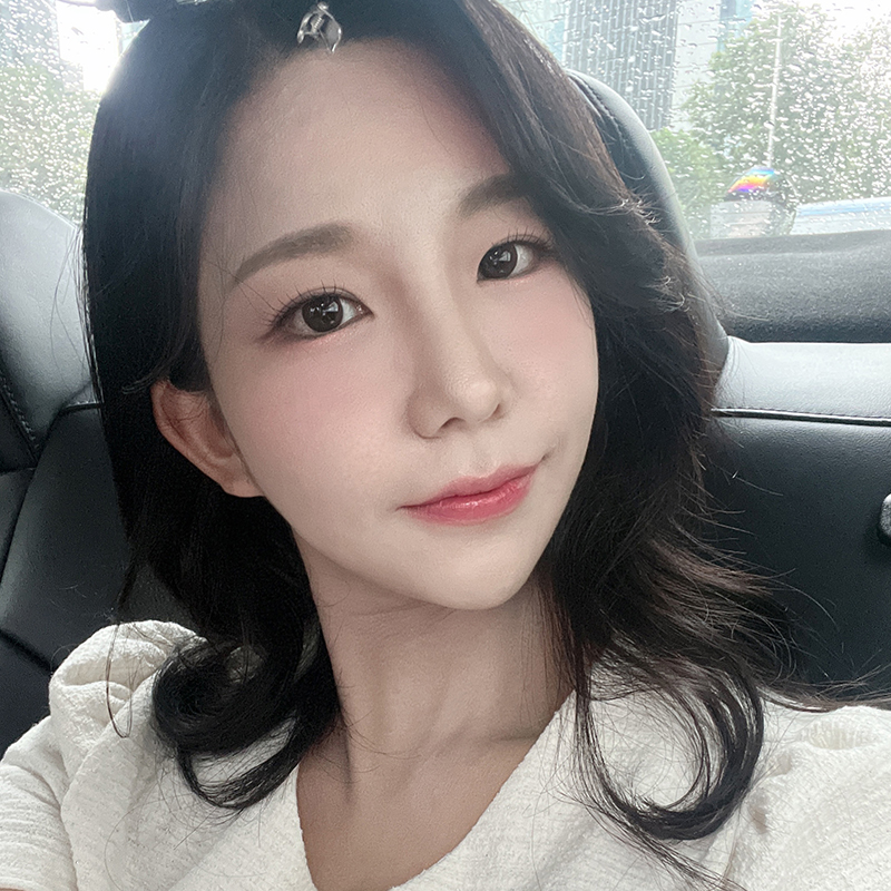 심부볼제거후기 이정도는 돼야죠 관련 이미지 6