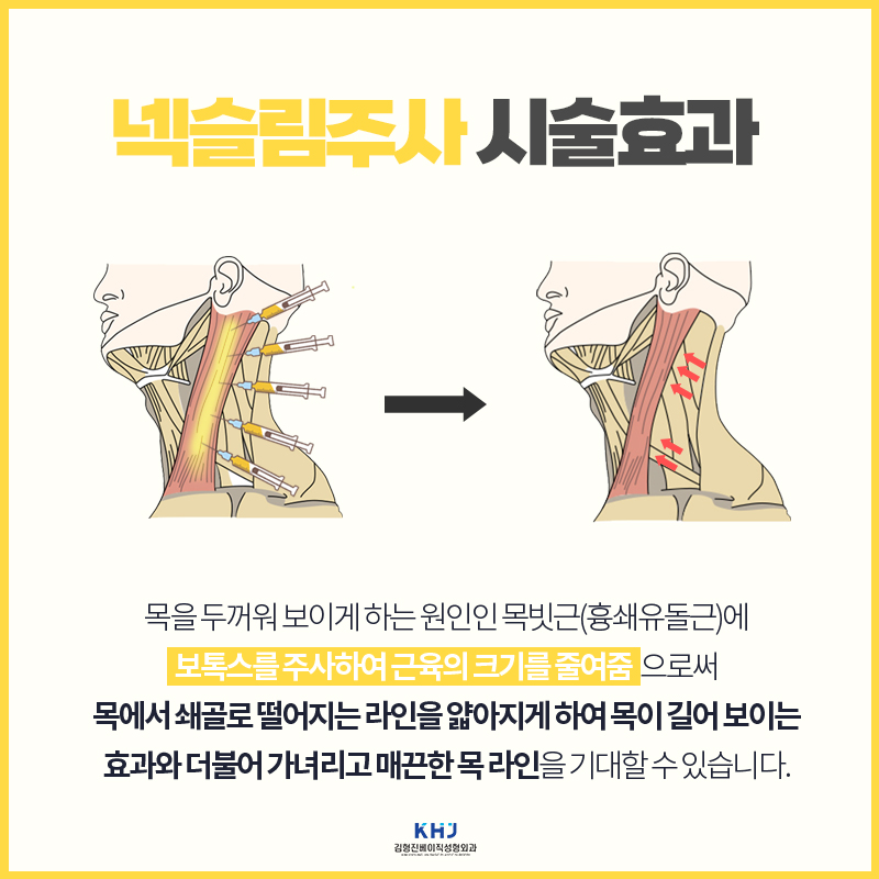 강남웨딩관리 넥슬림주사로 어깨 라인부터 목선까지 미리 관리해요! 관련 이미지 4