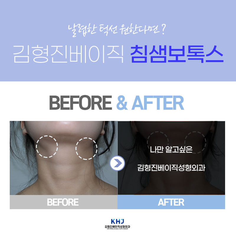 침샘치료도 역시 김형진베이직! 관련 이미지 3