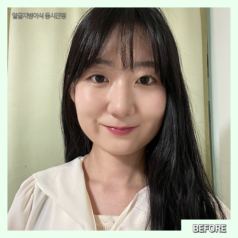 얼굴살빼는법 이렇게 간단한 방법이? 관련 이미지 2