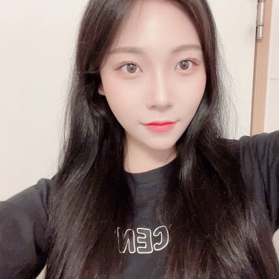 입꼬리시술 길게 고민 할 필요 없었어요 관련 이미지 2