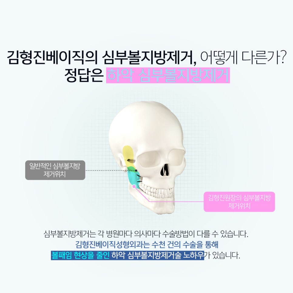 I Found the Way to Get Rid of the Deep Cheek Fat That Was Stressing Me Out! image 4
