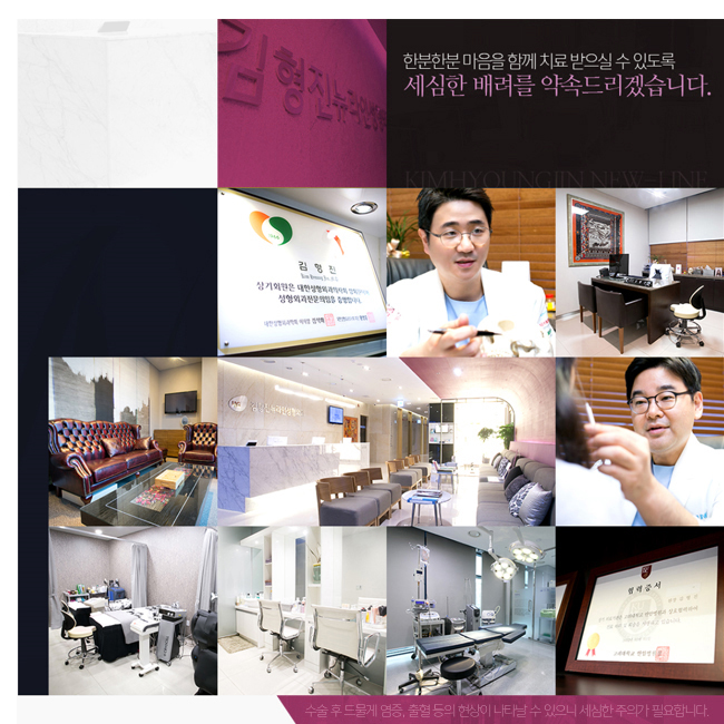 남자코성형 라인이 살아야지! 관련 이미지 4