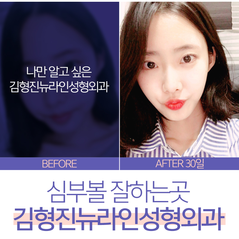 심부볼잘하는곳 이거레알 반박불가 관련 이미지 4