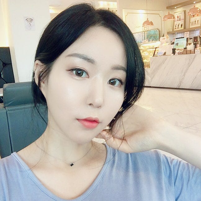 역대급 심부볼지방제거후기! 잃어버린 V라인 되찾았어요 관련 이미지 3