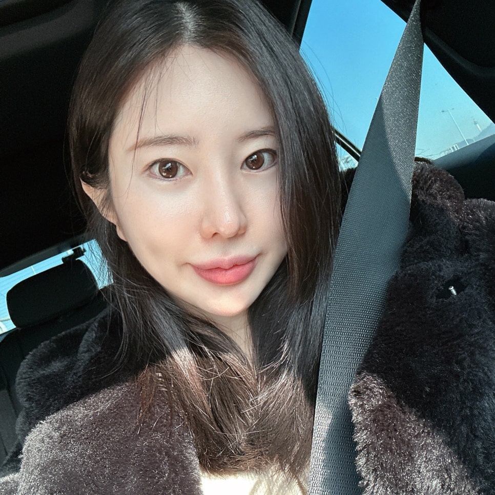 입꼬리시술 길게 고민 할 필요 없었어요 관련 이미지 3