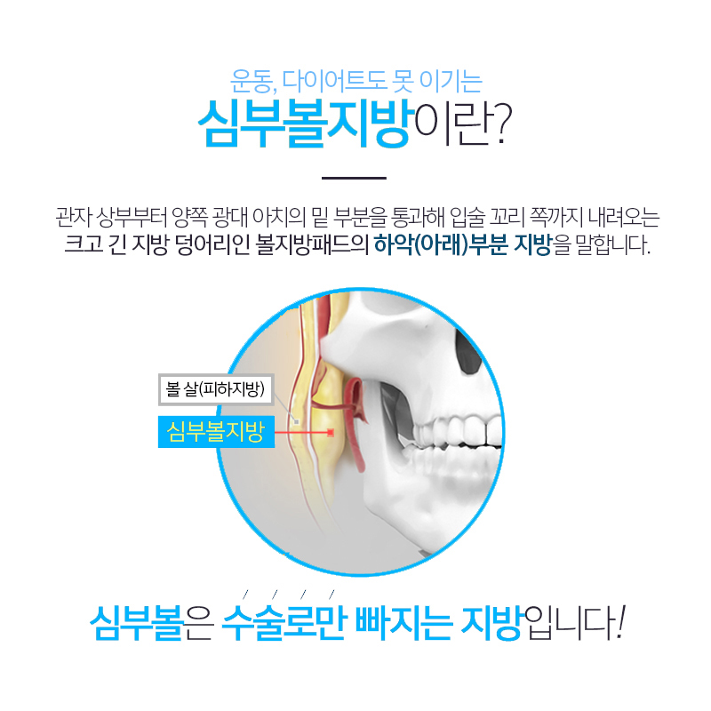 심부볼제거잘하는곳에서 볼살 없애고 왔어요! 관련 이미지 3