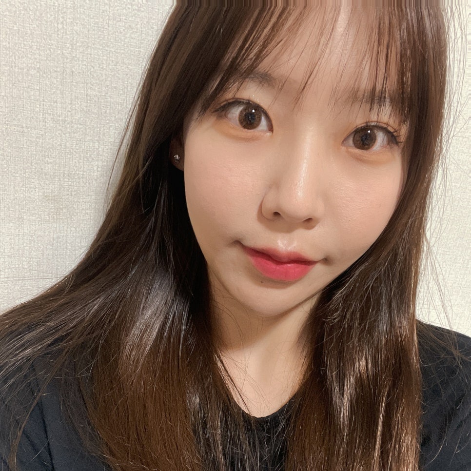 윈터 얼굴형 만들어 준 불독살제거방법 관련 이미지 2