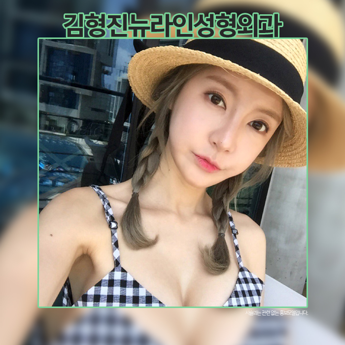 눈밑지방재배치멍 걱정? 김형진원장이라면 관련 이미지 1