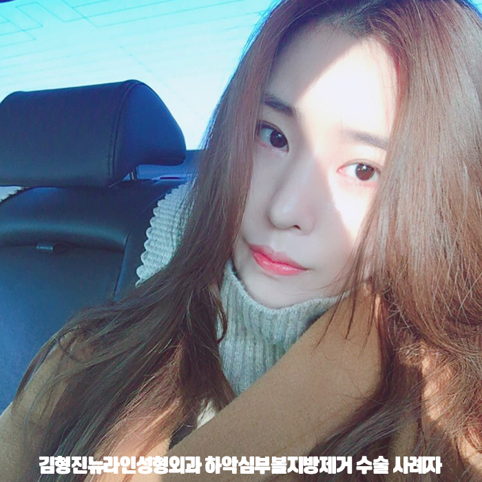 심술보윤곽주사 어림 없어요!! 관련 이미지 1