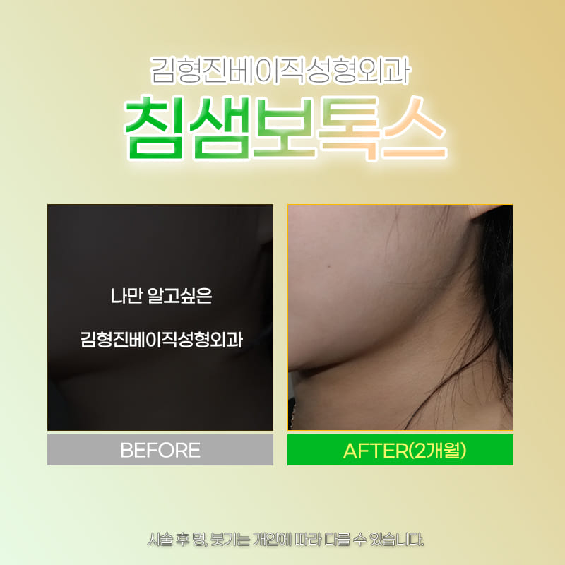 침샘치료후기 좋은 곳에서 고민 해결했어요 관련 이미지 6