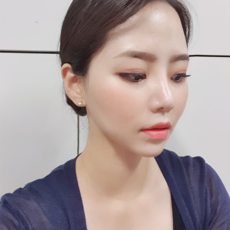 침샘비대증치료 김형진베이직으로 오세요! 관련 이미지 3