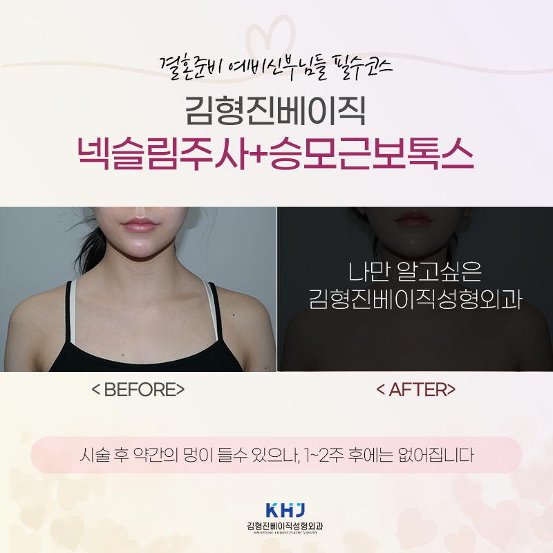 넥슬림주사효과? 이런 것도 있어요! 관련 이미지 5