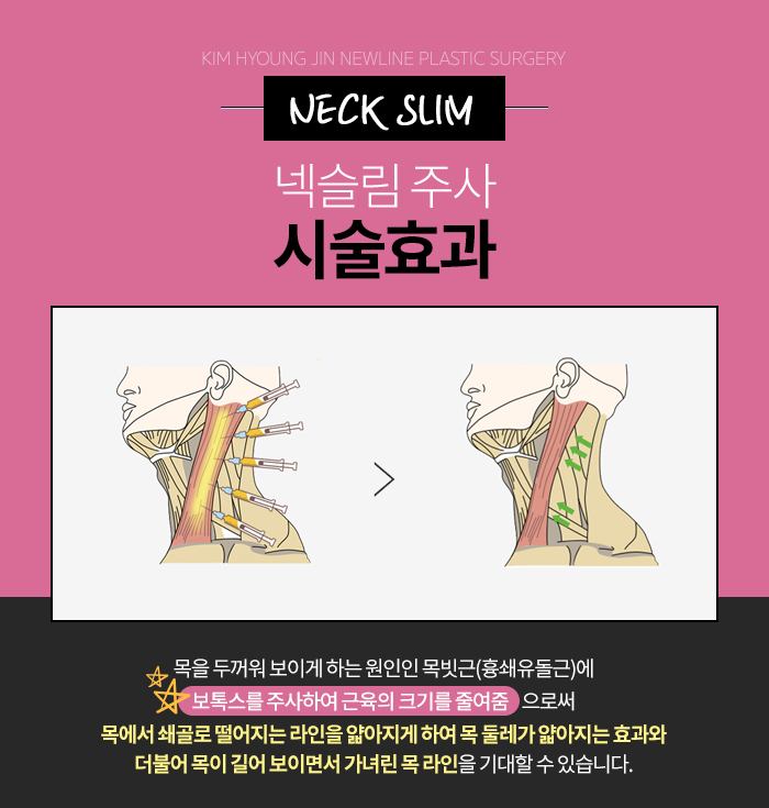 목얇아지는법 뭐야? 넥슬림주사지! 관련 이미지 4